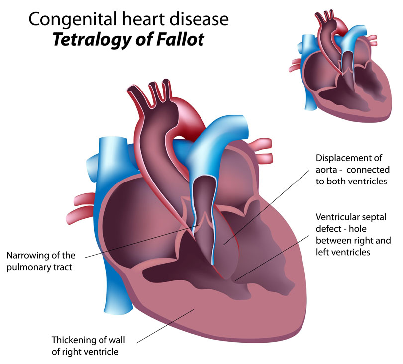 Common Health Concerns